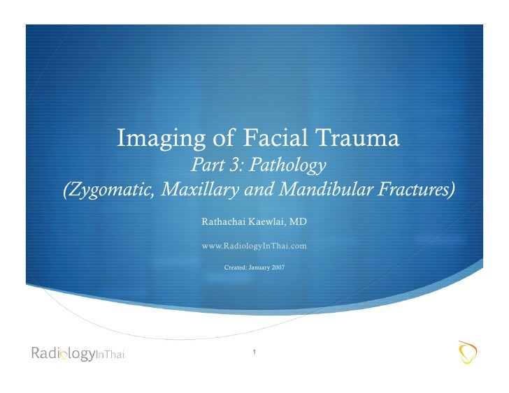 facial fracture slideshows Facial fracture slideshows